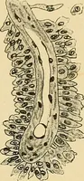 An illustration from A text-book of pathology for students of medicine / by J. George Adami and John McCrae ; illustrated with 304 engravings and 11 colored plates. (1912)