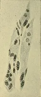 An illustration from A text-book of pathology for students of medicine / by J. George Adami and John McCrae ; illustrated with 304 engravings and 11 colored plates. (1912)