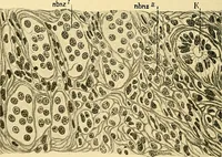 An illustration from A text-book of pathology for students of medicine / by J. George Adami and John McCrae ; illustrated with 304 engravings and 11 colored plates. (1912)