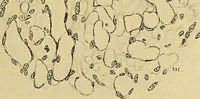 An illustration from A text-book of pathology for students of medicine / by J. George Adami and John McCrae ; illustrated with 304 engravings and 11 colored plates. (1912)