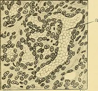 An illustration from A text-book of pathology for students of medicine / by J. George Adami and John McCrae ; illustrated with 304 engravings and 11 colored plates. (1912)