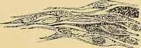 An illustration from A text-book of pathology for students of medicine / by J. George Adami and John McCrae ; illustrated with 304 engravings and 11 colored plates. (1912)