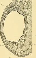 An illustration from A text-book of pathology for students of medicine / by J. George Adami and John McCrae ; illustrated with 304 engravings and 11 colored plates. (1912)