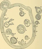 An illustration from A text-book of pathology for students of medicine / by J. George Adami and John McCrae ; illustrated with 304 engravings and 11 colored plates. (1912)