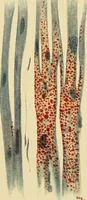 An illustration from A text-book of pathology for students of medicine / by J. George Adami and John McCrae ; illustrated with 304 engravings and 11 colored plates. (1912)