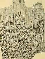 An illustration from A text-book of pathology for students of medicine / by J. George Adami and John McCrae ; illustrated with 304 engravings and 11 colored plates. (1912)
