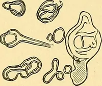 An illustration from A text-book of pathology for students of medicine / by J. George Adami and John McCrae ; illustrated with 304 engravings and 11 colored plates. (1912)