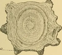 An illustration from A text-book of pathology for students of medicine / by J. George Adami and John McCrae ; illustrated with 304 engravings and 11 colored plates. (1912)