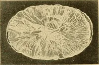 An illustration from A text-book of pathology for students of medicine / by J. George Adami and John McCrae ; illustrated with 304 engravings and 11 colored plates. (1912)
