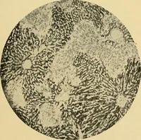 An illustration from A text-book of pathology for students of medicine / by J. George Adami and John McCrae ; illustrated with 304 engravings and 11 colored plates. (1912)