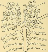 An illustration from A text-book of pathology for students of medicine / by J. George Adami and John McCrae ; illustrated with 304 engravings and 11 colored plates. (1912)