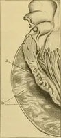 An illustration from A text-book of pathology for students of medicine / by J. George Adami and John McCrae ; illustrated with 304 engravings and 11 colored plates. (1912)