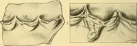 An illustration from A text-book of pathology for students of medicine / by J. George Adami and John McCrae ; illustrated with 304 engravings and 11 colored plates. (1912)