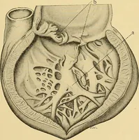 An illustration from A text-book of pathology for students of medicine / by J. George Adami and John McCrae ; illustrated with 304 engravings and 11 colored plates. (1912)