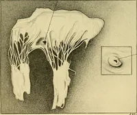 An illustration from A text-book of pathology for students of medicine / by J. George Adami and John McCrae ; illustrated with 304 engravings and 11 colored plates. (1912)