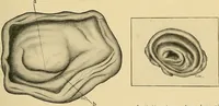 An illustration from A text-book of pathology for students of medicine / by J. George Adami and John McCrae ; illustrated with 304 engravings and 11 colored plates. (1912)