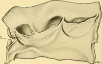 An illustration from A text-book of pathology for students of medicine / by J. George Adami and John McCrae ; illustrated with 304 engravings and 11 colored plates. (1912)