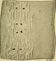 An illustration from A text-book of pathology for students of medicine / by J. George Adami and John McCrae ; illustrated with 304 engravings and 11 colored plates. (1912)