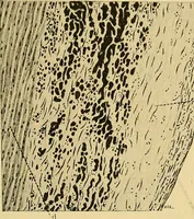 An illustration from A text-book of pathology for students of medicine / by J. George Adami and John McCrae ; illustrated with 304 engravings and 11 colored plates. (1912)