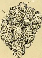 An illustration from A text-book of pathology for students of medicine / by J. George Adami and John McCrae ; illustrated with 304 engravings and 11 colored plates. (1912)