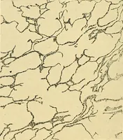 An illustration from A text-book of pathology for students of medicine / by J. George Adami and John McCrae ; illustrated with 304 engravings and 11 colored plates. (1912)