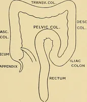 An illustration from A text-book of pathology for students of medicine / by J. George Adami and John McCrae ; illustrated with 304 engravings and 11 colored plates. (1912)