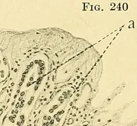 Picture 136 of 168 from A text-book of pathology for students of medicine / by J. George Adami and John McCrae ; illustrated with 304 engravings and 11 colored plates. (1912), leaf 572