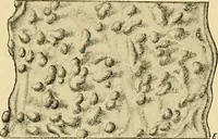 An illustration from A text-book of pathology for students of medicine / by J. George Adami and John McCrae ; illustrated with 304 engravings and 11 colored plates. (1912)