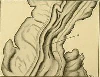 An illustration from A text-book of pathology for students of medicine / by J. George Adami and John McCrae ; illustrated with 304 engravings and 11 colored plates. (1912)