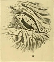 Picture 142 of 168 from A text-book of pathology for students of medicine / by J. George Adami and John McCrae ; illustrated with 304 engravings and 11 colored plates. (1912), leaf 588
