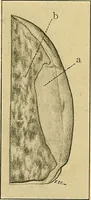 An illustration from A text-book of pathology for students of medicine / by J. George Adami and John McCrae ; illustrated with 304 engravings and 11 colored plates. (1912)