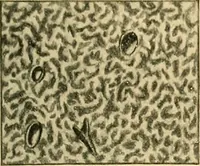 An illustration from A text-book of pathology for students of medicine / by J. George Adami and John McCrae ; illustrated with 304 engravings and 11 colored plates. (1912)