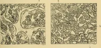 An illustration from A text-book of pathology for students of medicine / by J. George Adami and John McCrae ; illustrated with 304 engravings and 11 colored plates. (1912)
