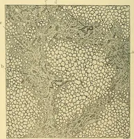 An illustration from A text-book of pathology for students of medicine / by J. George Adami and John McCrae ; illustrated with 304 engravings and 11 colored plates. (1912)