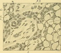 An illustration from A text-book of pathology for students of medicine / by J. George Adami and John McCrae ; illustrated with 304 engravings and 11 colored plates. (1912)