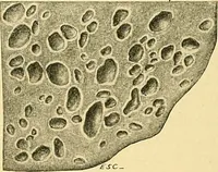 An illustration from A text-book of pathology for students of medicine / by J. George Adami and John McCrae ; illustrated with 304 engravings and 11 colored plates. (1912)