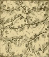 An illustration from A text-book of pathology for students of medicine / by J. George Adami and John McCrae ; illustrated with 304 engravings and 11 colored plates. (1912)