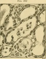 An illustration from A text-book of pathology for students of medicine / by J. George Adami and John McCrae ; illustrated with 304 engravings and 11 colored plates. (1912)