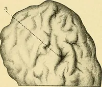 An illustration from A text-book of pathology for students of medicine / by J. George Adami and John McCrae ; illustrated with 304 engravings and 11 colored plates. (1912)