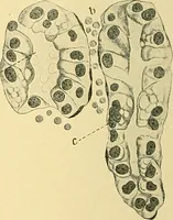 An illustration from A text-book of pathology for students of medicine / by J. George Adami and John McCrae ; illustrated with 304 engravings and 11 colored plates. (1912)
