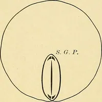An illustration from A text-book of pathology for students of medicine / by J. George Adami and John McCrae ; illustrated with 304 engravings and 11 colored plates. (1912)