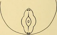 An illustration from A text-book of pathology for students of medicine / by J. George Adami and John McCrae ; illustrated with 304 engravings and 11 colored plates. (1912)