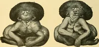 Picture 21 of 168 from A text-book of pathology for students of medicine / by J. George Adami and John McCrae ; illustrated with 304 engravings and 11 colored plates. (1912), leaf 70