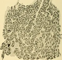 An illustration from A text-book of pathology for students of medicine / by J. George Adami and John McCrae ; illustrated with 304 engravings and 11 colored plates. (1912)