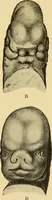 Picture 25 of 168 from A text-book of pathology for students of medicine / by J. George Adami and John McCrae ; illustrated with 304 engravings and 11 colored plates. (1912), leaf 75