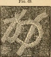 An illustration from The household physician : for the use of families, planters, seamen, and travellers ; being a brief description, in plain language, of all the diseases of men, women, and children, with the newest and most approved methods of curing them / by Ira Warren. (1866)