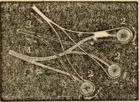 An illustration from The household physician : for the use of families, planters, seamen, and travellers ; being a brief description, in plain language, of all the diseases of men, women, and children, with the newest and most approved methods of curing them / by Ira Warren. (1866)