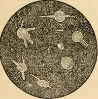 An illustration from The household physician : for the use of families, planters, seamen, and travellers ; being a brief description, in plain language, of all the diseases of men, women, and children, with the newest and most approved methods of curing them / by Ira Warren. (1866)
