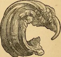An illustration from The household physician : for the use of families, planters, seamen, and travellers ; being a brief description, in plain language, of all the diseases of men, women, and children, with the newest and most approved methods of curing them / by Ira Warren. (1866)