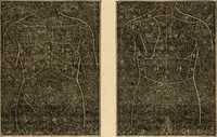 An illustration from The household physician : for the use of families, planters, seamen, and travellers ; being a brief description, in plain language, of all the diseases of men, women, and children, with the newest and most approved methods of curing them / by Ira Warren. (1866)